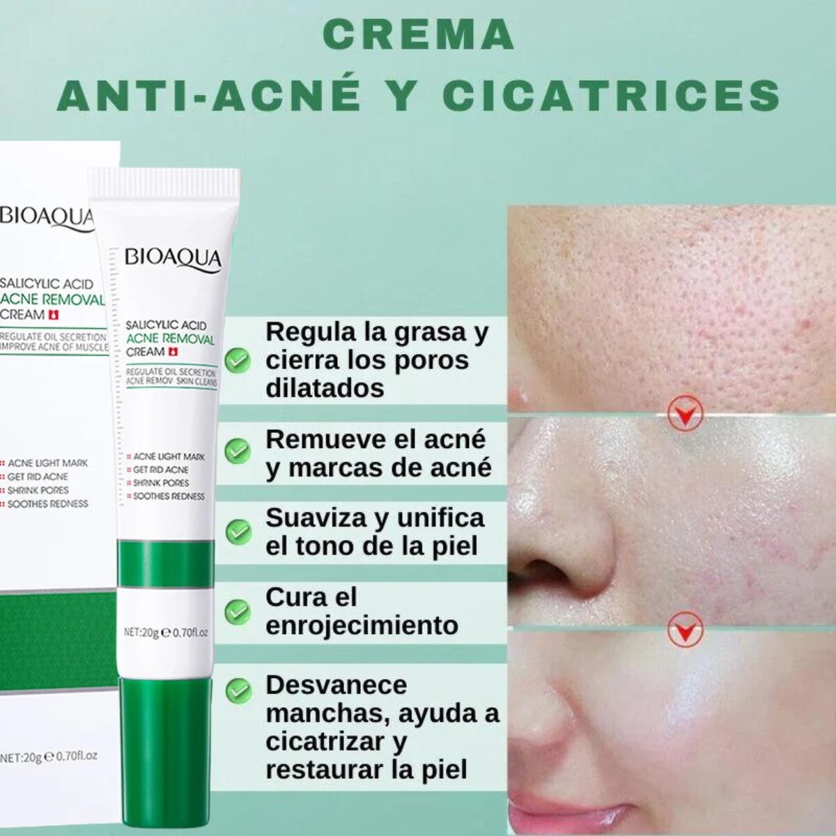 CREMA ANTIACNE DE ACIDOSALICILICO BIOAQUA